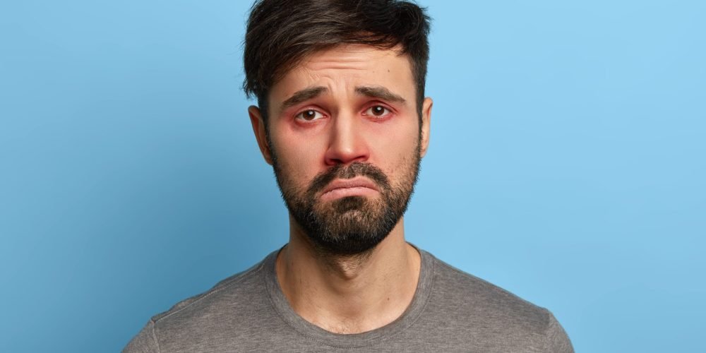 Miserable displeased man has sick look, red swollen eyes, smirks face, suffers from conjunctivitis, seasonal allergy, poses against blue background. People, disease, health problems concept. Miserable displeased man has sick look, red swollen eyes, smirks face, suffers from conjunctivitis, seasonal allergy, poses against blue background. People, disease, health problems concept.
